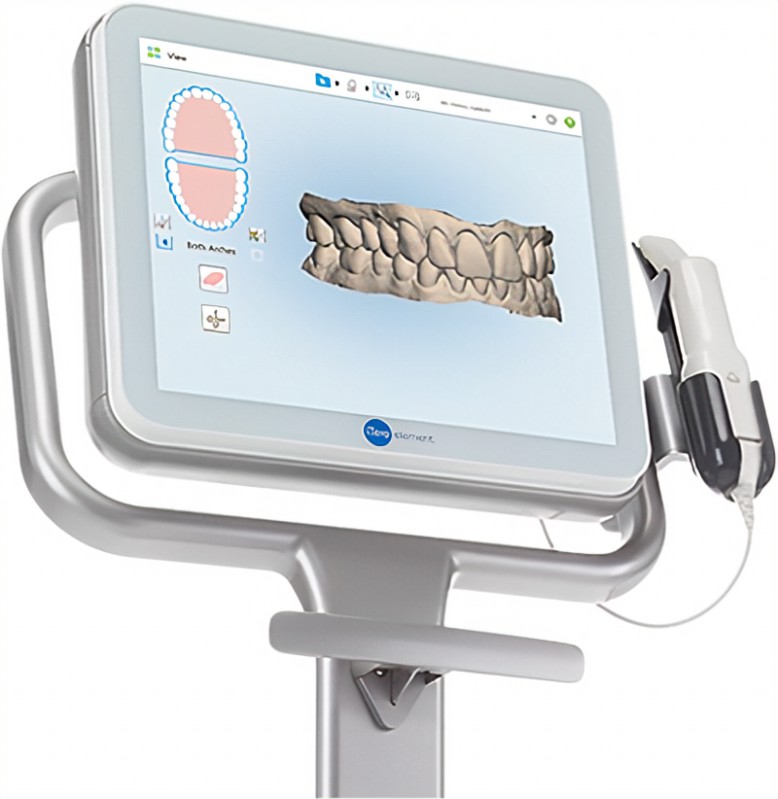 Itero® Digital Impression System Great New Smile Windsor Ct